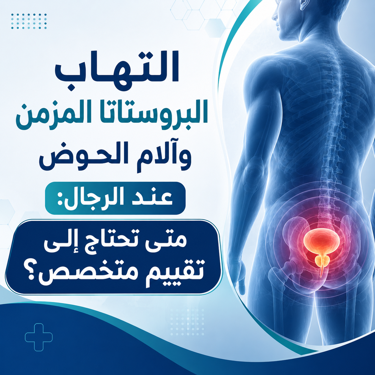 . التهاب البروستاتا المزمن وآلام الحوض عند الرجال: متى تحتاج إلى تقييم متخصص؟